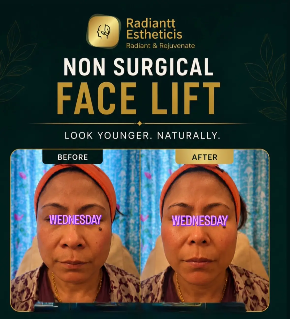 Client result
